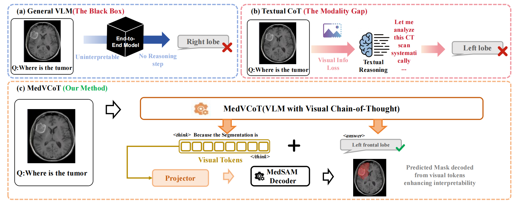 Overview of MedVCoT methodology